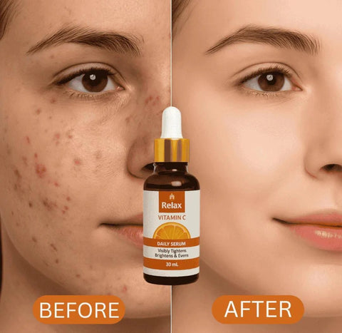 Buy Ordinary Niacinamide 10% + Zinc 1 % & Get Relax Vitamin C Daily Brightening & Anti-Aging Free Serum