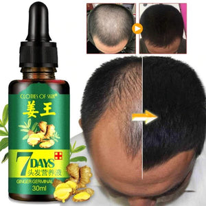 pack of 2 GINGER GERMINAL OIL for fast hair growth (original)