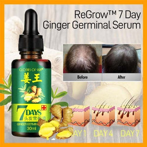 pack of 2 GINGER GERMINAL OIL for fast hair growth (original)