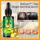 pack of 2 GINGER GERMINAL OIL for fast hair growth (original)
