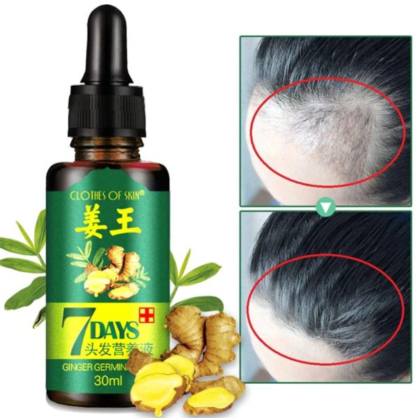 pack of 2 GINGER GERMINAL OIL for fast hair growth (original)