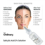 The Ordinary Niacinamide Serum [buy 1 Get 1 Free]