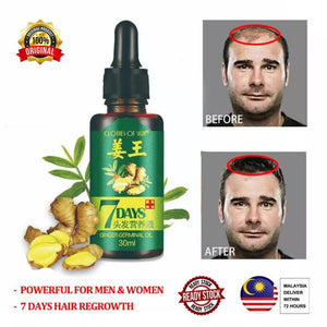 pack of 2 GINGER GERMINAL OIL for fast hair growth (original)