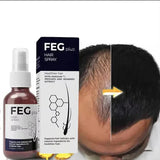 Feg Plus Hair Growth Serum Spray 50ml | 22% Seaweed Extract, Rosemary, Redensyl, Anagain & 5% Minoxidil | Anti Hair Loss, Regrowth Treatment